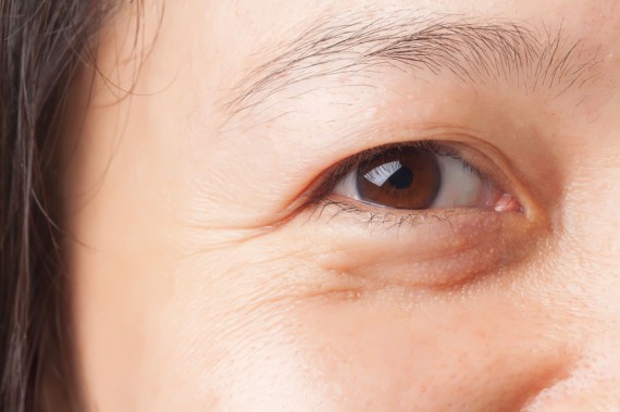 cách chống nhăn vùng  mắt 